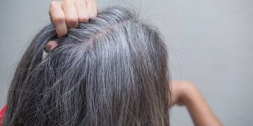 Tóc Bạc Sớm Do đâu Có Chữa được Không