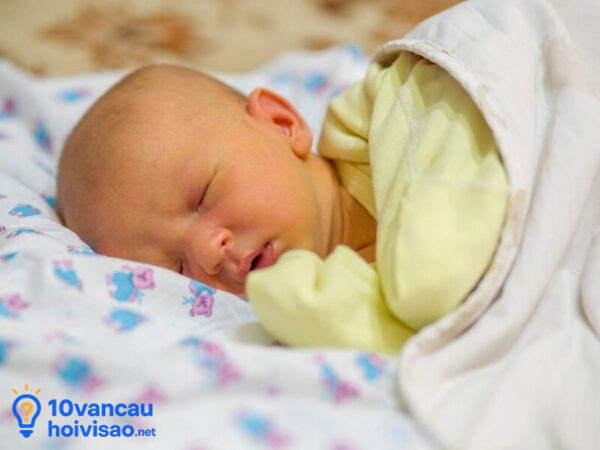 Vàng Da Sinh Lý ở Trẻ Sơ Sinh